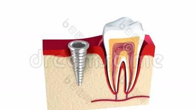 颌骨健康<strong>牙齿</strong>及<strong>种植</strong>牙的解剖..